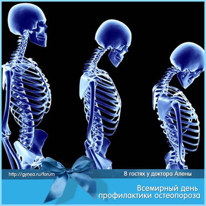 Всемирный день остеопороза